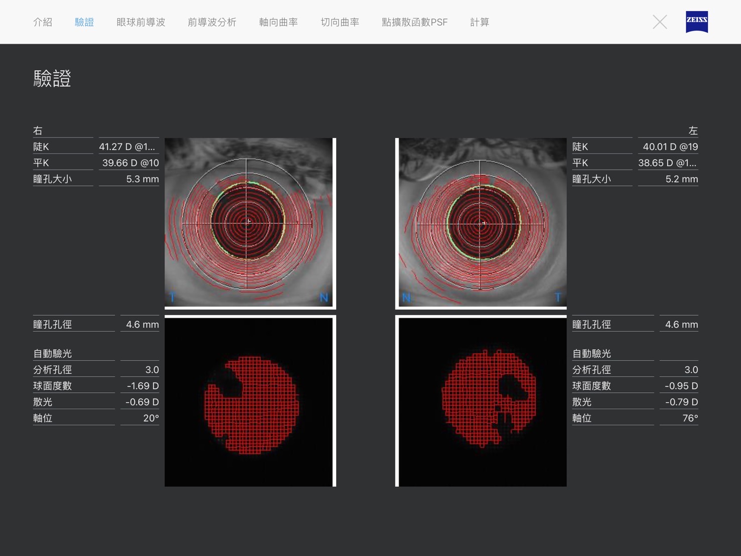 桃園中壢靖美眼鏡｜專業蔡司驗光桃園配眼鏡推薦，全桃園首間使用全套德國蔡司儀器驗光檢測，超專業 @瑪姬幸福過日子